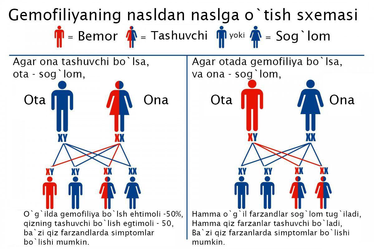 Gemofiliyaning nasldan naslga o`tishi
Gemofiliyaning nasldan naslga o`tishi
